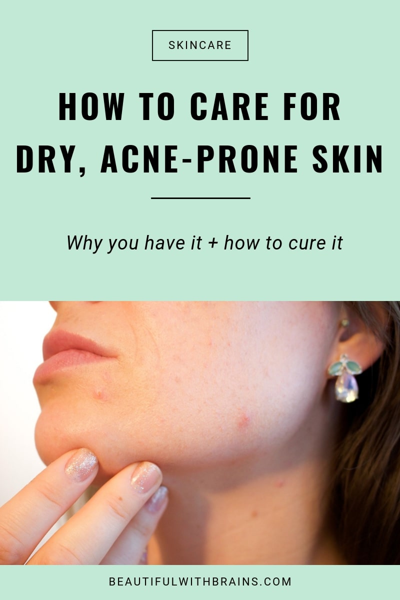 dry acne-prone skin causes cures